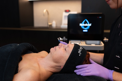 Hydrafacial behandeling